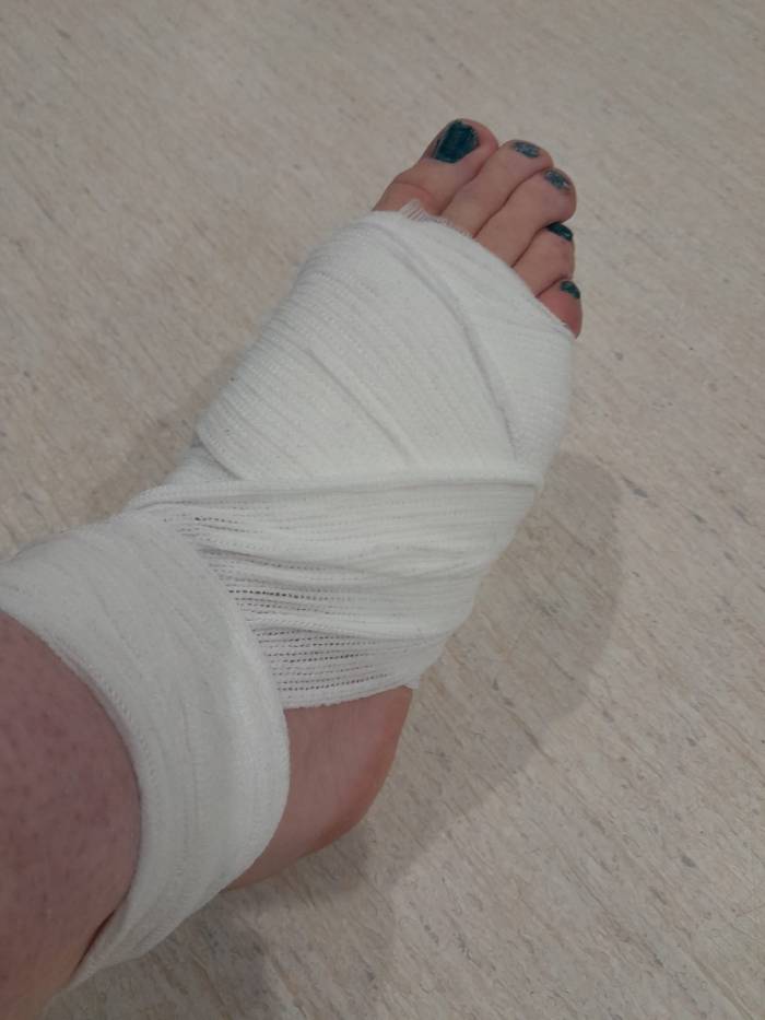 My foot: an update